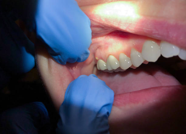 Best Weekend Emergency Dentist in Fredericktown, OH