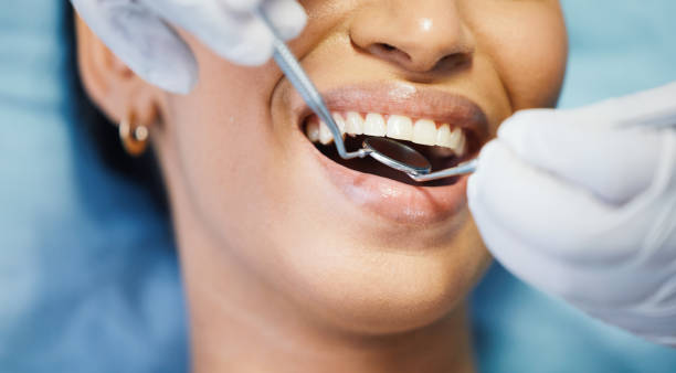 Best After-Hours Emergency Dentist in Fredericktown, OH